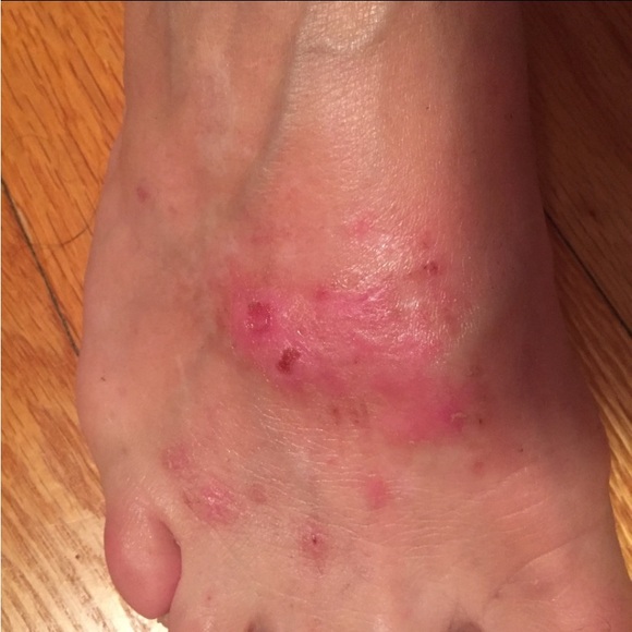 🛍️ Lg 4 oz Miracle Healing Balm, SUNDAY NIGHT SALE!! #momma #elevatedskincare - Picture 9 of 16